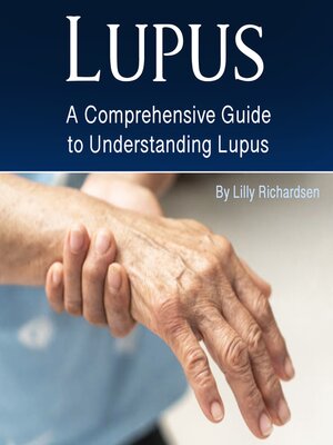 cover image of Lupus